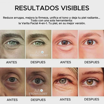 Varita Facial 4-en-1 Para Skincare